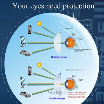 Anti-Blue Ray Lens Presbyopi Recept Optiske Linser, Briller Linse Til Øjne Beskyttelse Læsning Briller lentes opticos
