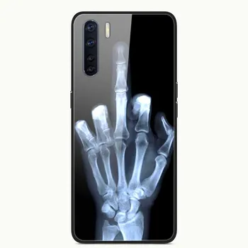 Glas Tilbage Dække For Huawei Y5 2019 Sag Hærdet Glas Telefonen Sagen Til Ære 8S Tilfælde Ære 9 Phone Cover Til Huawei Nova 5i Sag